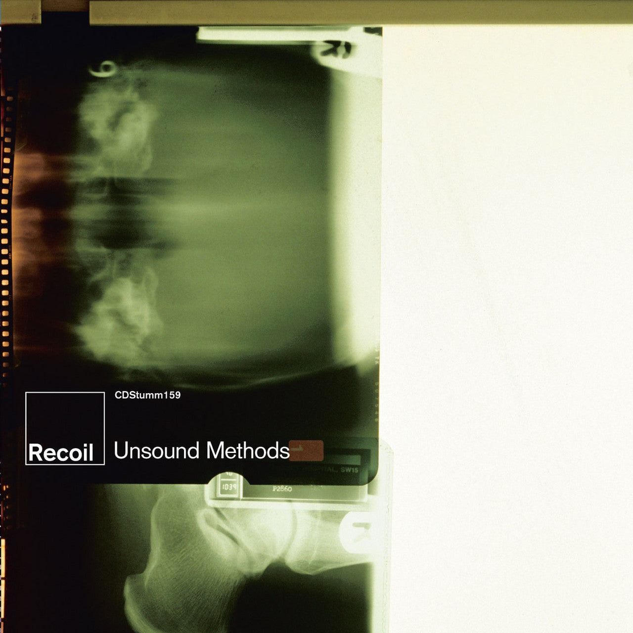 Recoil - Unsound Methods (Limited Edition Green and Clear Vinyl)